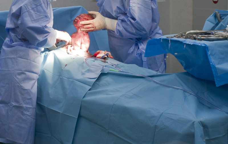 Elective Cesarean Is Gaining Popularity