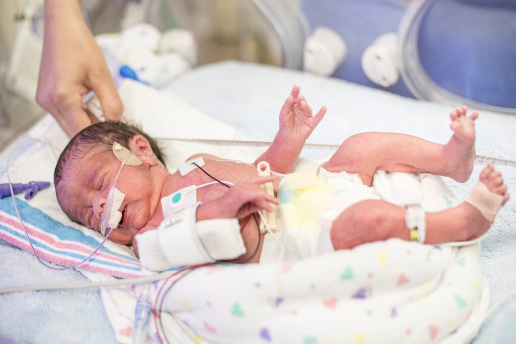 Mother touching her premature newborn baby as he is hooked up to an IV and health monitors while being treated in intensive care.